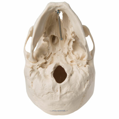 Skull with Cleft Jaw and Plate A29/3 4