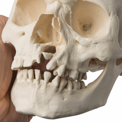 Skull with Cleft Jaw and Plate A29/3 5