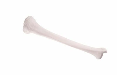 Tibia  A35/3 1