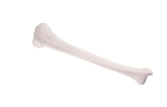 Tibia  A35/3