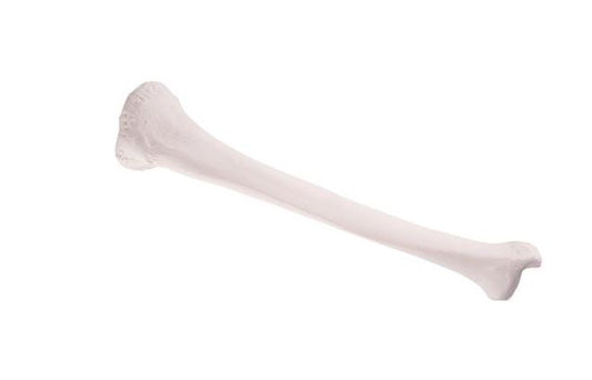 Tibia  A35/3