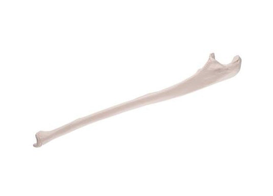 Ulna A45/2