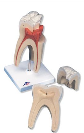 Upper Triple-Root Molar 3 Parts   D10/5