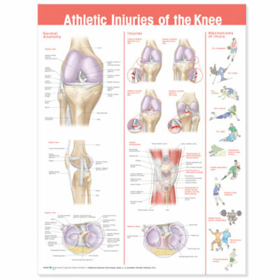 Athletic Injuries of the Knee Anatomical Chart 9871 1