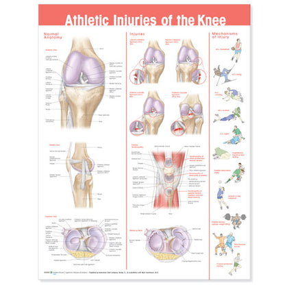 Athletic Injuries of the Knee Anatomical Chart 9871
