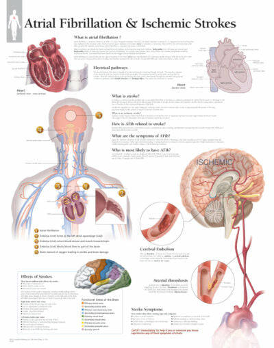 Atrial Fibrillation and Ischemic Strokes 1456 1