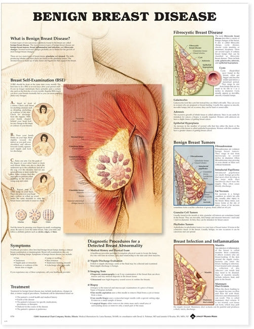 Benign Breast Disease Anatomical Chart 9759