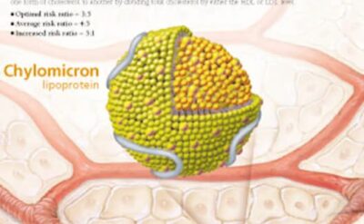 Cholesterol 1651 3