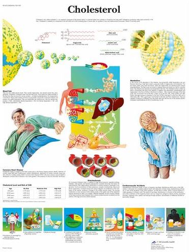 Cholesterol Chart VR1452