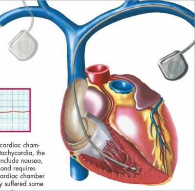 Common Cardiac Disorders Chart VR1343 2