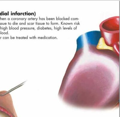 Common Cardiac Disorders Chart VR1343 1