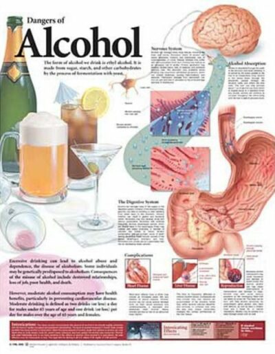 Dangers of Alcohol Anatomical Chart 9696 1
