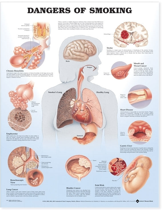 Dangers of Smoking Anatomical Chart 9865