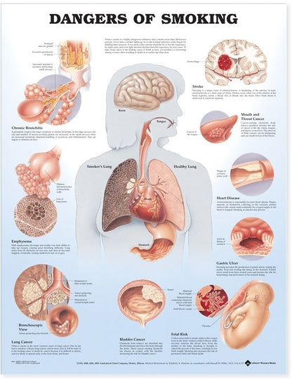 Dangers of Smoking Anatomical Chart 9865