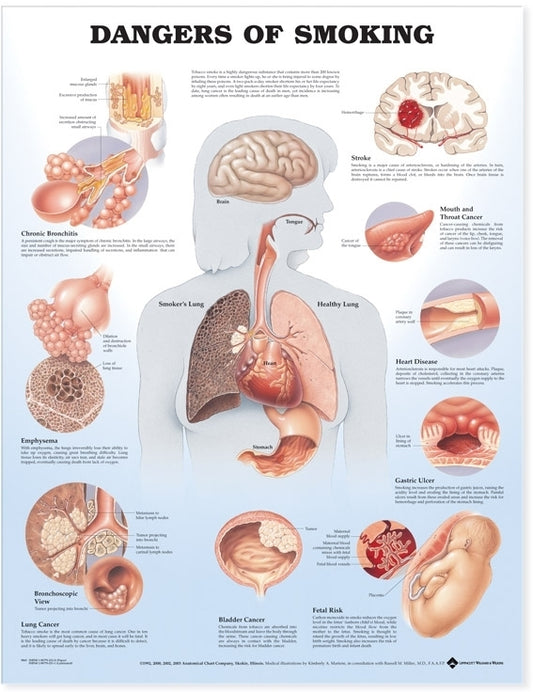 Dangers of Smoking Anatomical Chart 9865