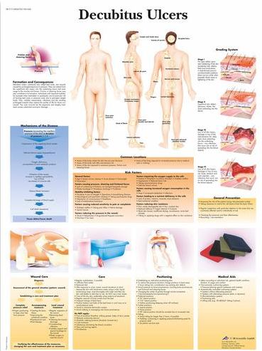 Decubitus Ulcers Chart VR1717