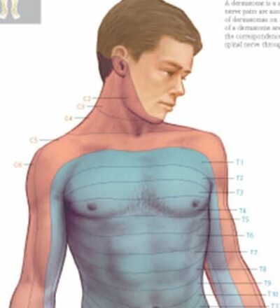 Dermatomes 2702 3