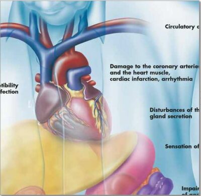 Diabetes Mellitus Chart VR1441 1