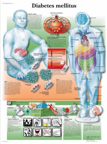 Diabetes Mellitus Chart VR1441