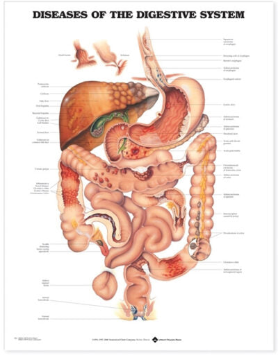 Diseases of the Digestive System Anatomical Chart 9861 1