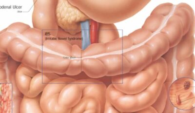 Diseases of Digestive System 1552 3