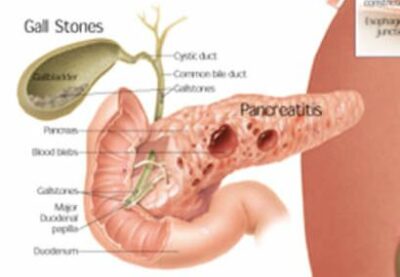 Diseases of Digestive System 1552 2