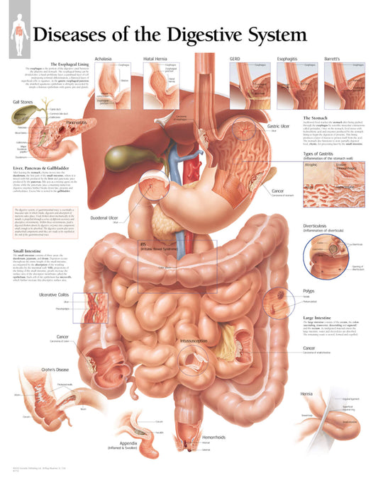 Diseases of Digestive System 1552
