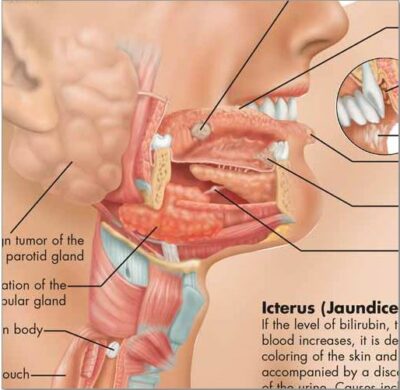 Diseases of the Digestive System Chart VR1431 2