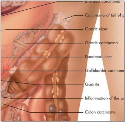 Diseases of the Digestive System Chart VR1431 1