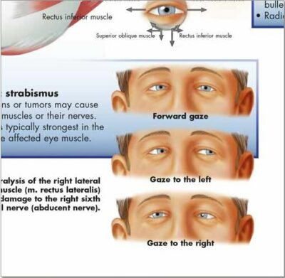 Diseases of the Eye Chart VR1231 2
