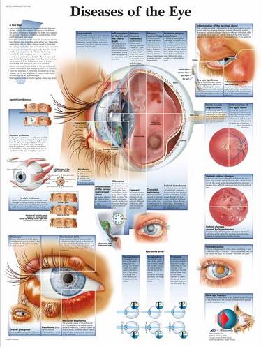 Diseases of the Eye Chart VR1231