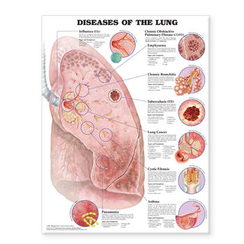 Diseases of the Lung