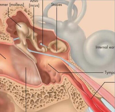 Diseases of the Middle Ear Chart VR1252 2