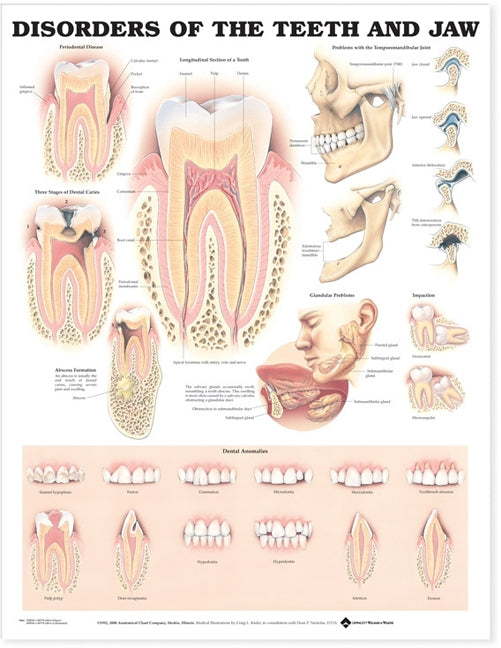 Disorders of the Teeth and Jaw Anatomical Chart 9866