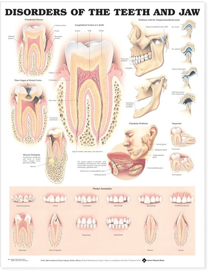 Disorders of the Teeth and Jaw Anatomical Chart 9866