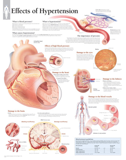 Effects of Hypertension 1451