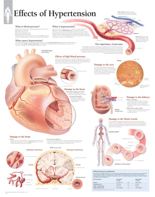 Effects of Hypertension 1451