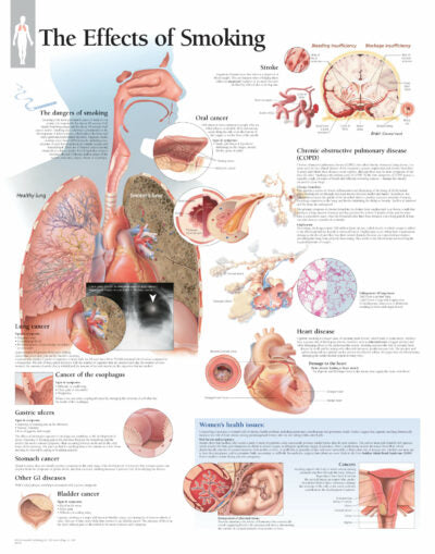 Effects of Smoking 1352 1