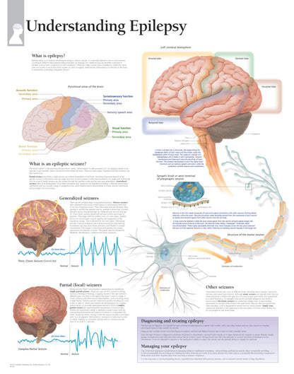 Epilepsy 1754