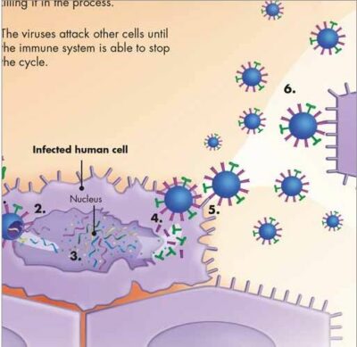 Flu (Influenza) Chart VR1722 2