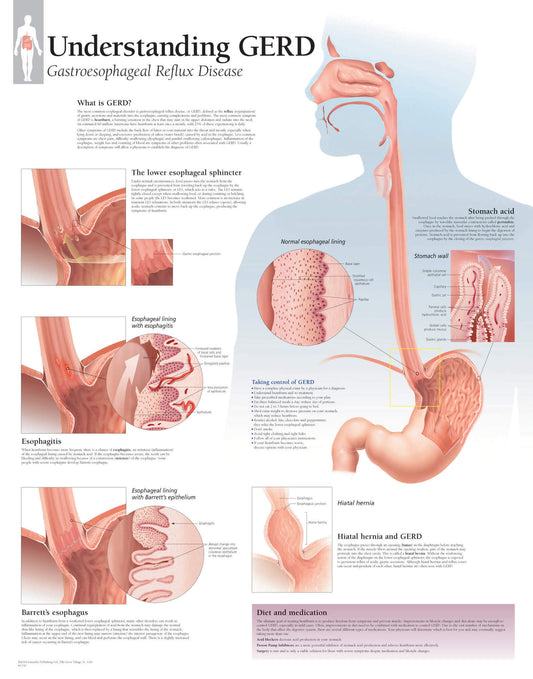Gastroesophageal Reflux Disease (GERD) 1550
