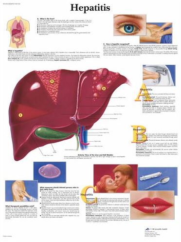 Hepatitis Chart VR1435