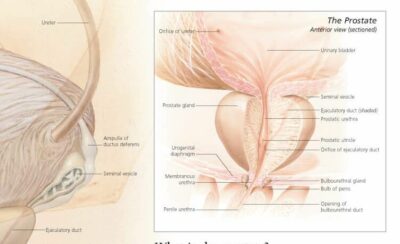 Male Reproductive System 4000 3