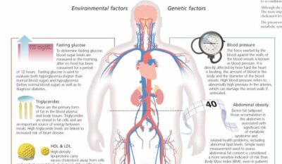 Metabolic Syndrome 1654 2