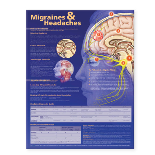 Migraines and Headaches Anatomical Chart 9979