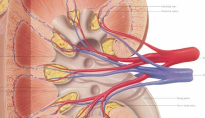 Kidney 2000 3