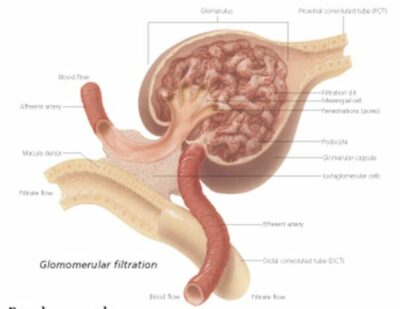 Kidney 2000 2