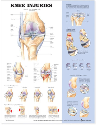 Knee Injuries Anatomical Chart 9872 1