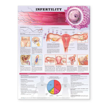 Infertility Anatomical Chart 9740 1