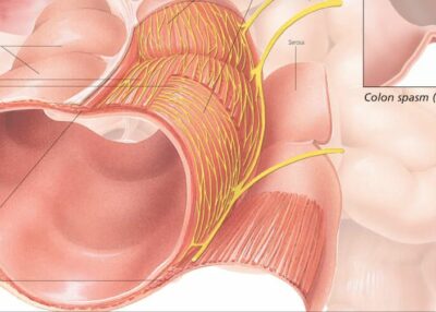 Irritable Bowel Syndrome 1551 3